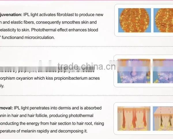 Hair Removal Machine for Women in Laser Beauty photo-4