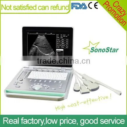 Sonostar Cheapest Portable Ultrasound Machine Device Veterinary Ultrasound SS-7 / V7