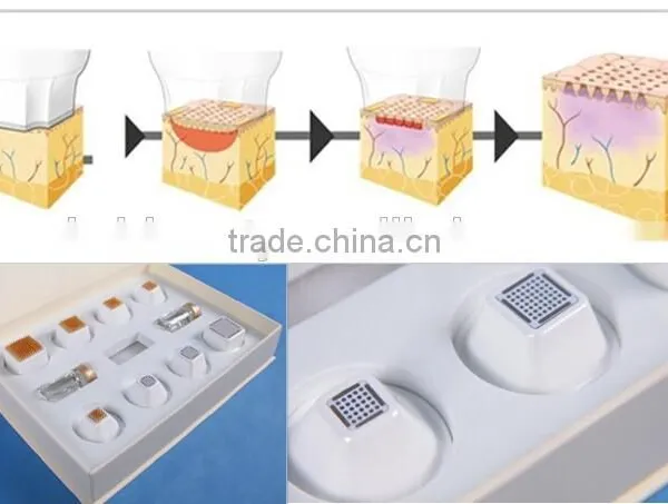 Hot Sale Portable Home-use RF 9D Thermacool Skin Resurfacing and RF Thermacool Effectively Machine photo-6