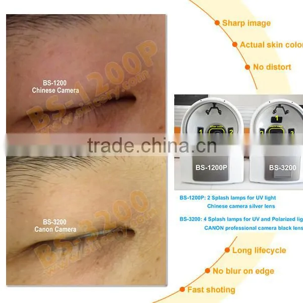 Skin Analyzer Type Skin and Hair Analysis Machine photo-4