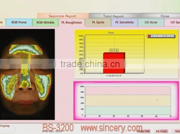 2014 Latest Magic Mirror System 3d Skin Analyzer photo-3