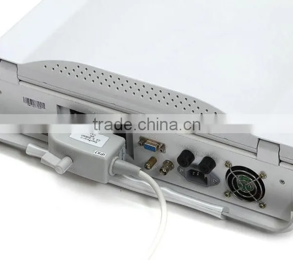 High Frequency Linear Probe Micro-convex Probe Convex Probe Laptop Ultrasound Scanner photo-4