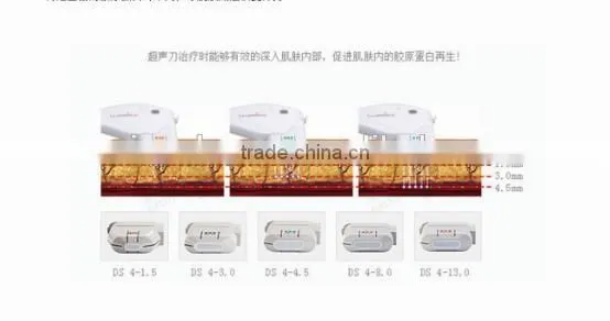 Protable Hifu Korea Face Lift/ Slimming Machine/ High Intensity Focused Untrasound photo-3