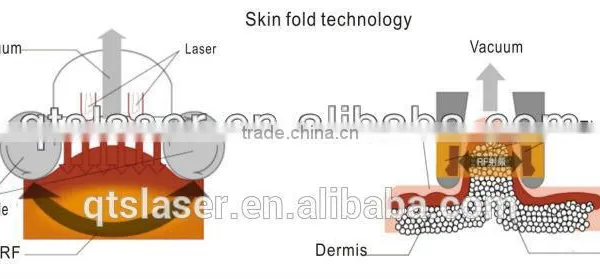 Weight Lose/ Weight Losing Celliute Losing Sliiming Machine 7in 1 (seven Functions in One) photo-4
