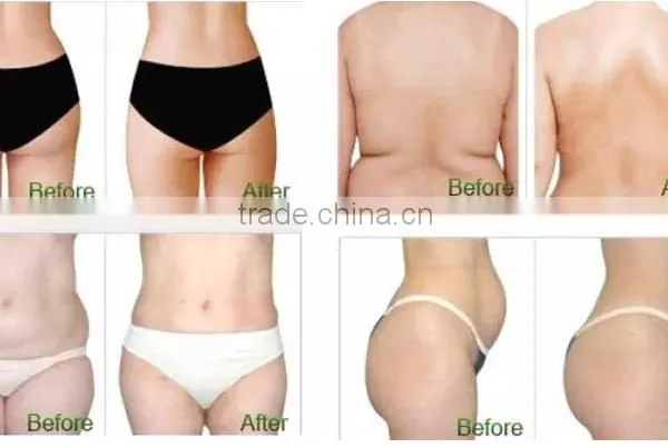 CE Marked Advanced Medical Weight Loss Cooplas Fat Freezing Beauty Equipment photo-4