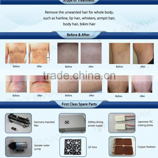 Top Quality Best Seller Permanent Result Diode Laser 10 Layer Laser Bars 808nm Diode Laser Hair Removal 3 Years Warranty photo-6