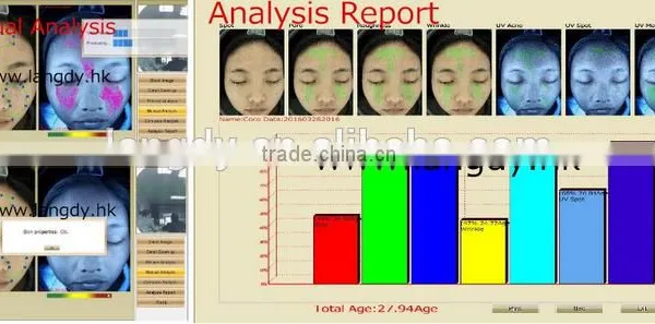 Skin Analyzer System for Beauty Parlor Test Image Recording Skin Problems Analysis photo-3