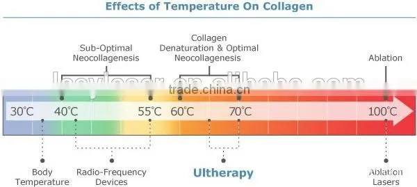 High Intensity Focused Ultrasound Hifu/ Hifu Anti-wrinkle With Amazing Effect photo-3