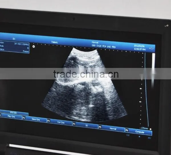 CE Ultrasonic System PC Platform 10.4 Inch Laptop Ultrasound Scanner / Machine With 3.5Mhz Convex Probe Li-ion Battery photo-5