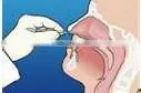 Nasal Cavity Specimen Collection/sampling Swab photo-4