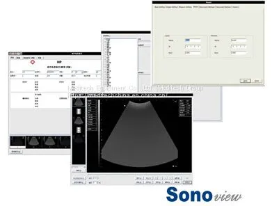 Top Quality 3D B/W Doppler Sonoview Machine Trolley Ultrasound Scanner photo-3