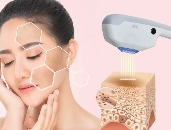 Hot Sale Dual Handpiece E-light IPL Super HR Hair Removal DPL Pigment Removal DPL Machine photo-5