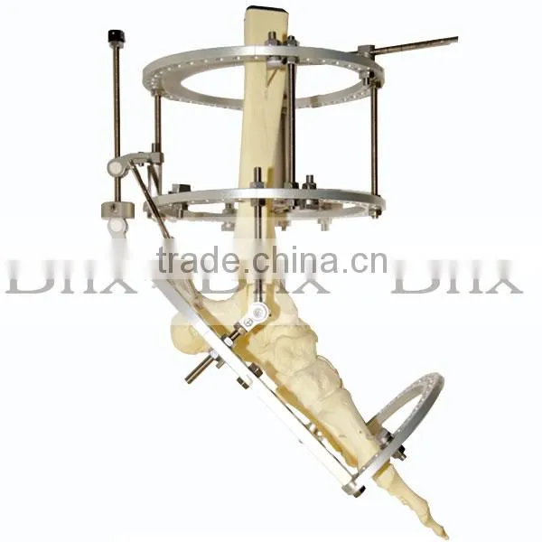 Circular Fixator in Orthofix Shape photo-3