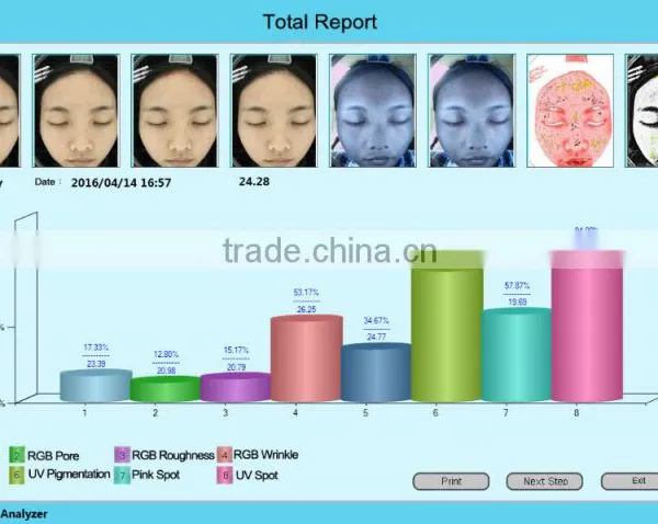 Skin Acne Spot Wrinkle Pore Moisture Skin Color Skin Sensitivity Facial Analyzer 3D Scanner photo-3