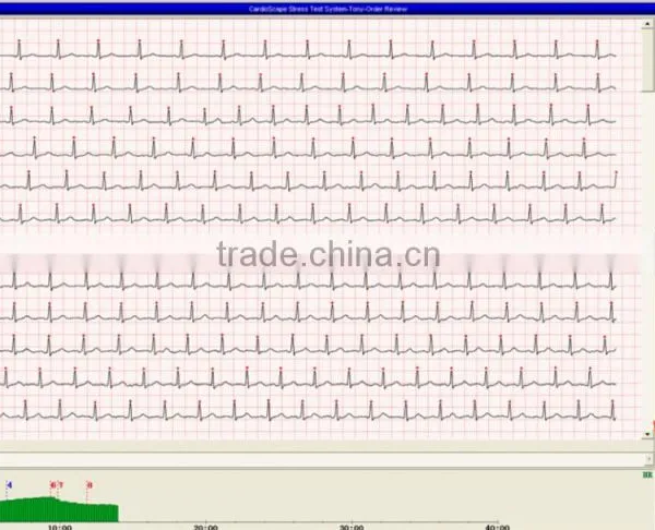 StressTest ECG System With PC Software Holter Algorithm for Heart Rate Triggering Treadmill photo-6