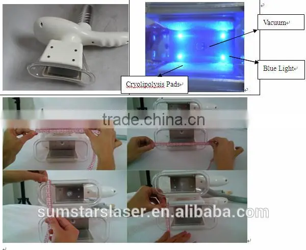 2015 New Design Slimming Machine/weight Loss Machine/ Cavitation Slimming Machine Factory Direct Sale photo-6