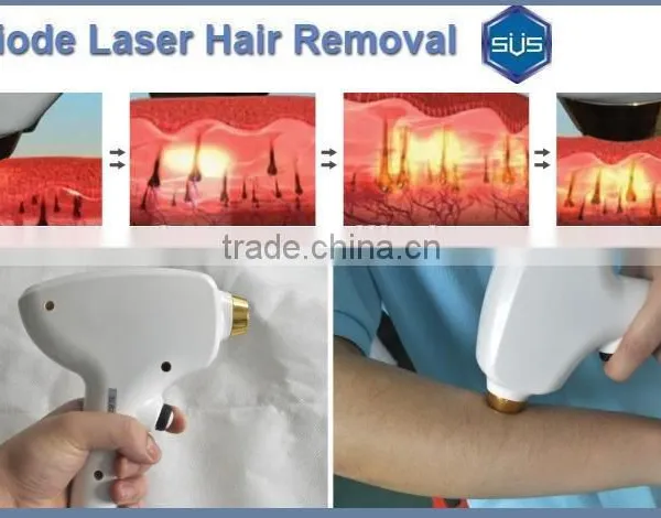 Latest Technology 808nm Diode Laser Professional Hair Removal Machine photo-5