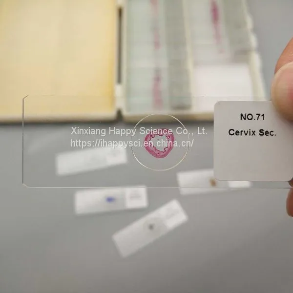Lab and Medical Pathology Histology Microscope Slides photo-2