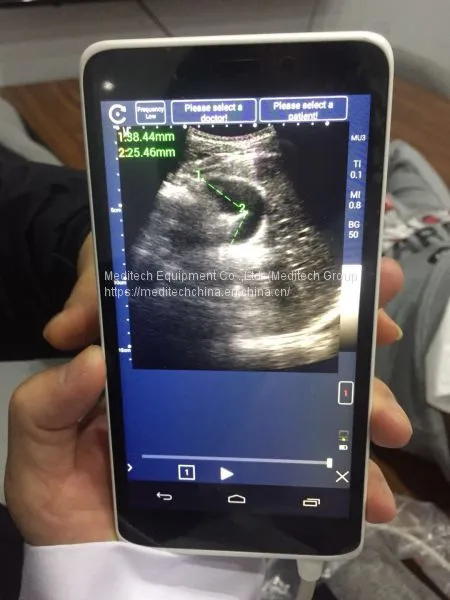 Meditech C-Scan Handheld Touch Screen Color Ultrasound Scanner Medical Supply photo-2