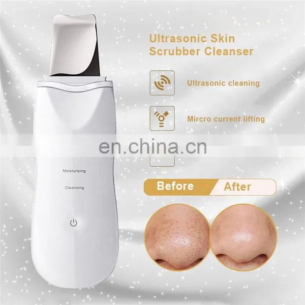 Ultrasonic Ion Skin Scrubber Facial Care Ultrasonic Scrubber Cleaner Blackhead Removal Face Peeling Extractor Skin Beauty Device photo-2