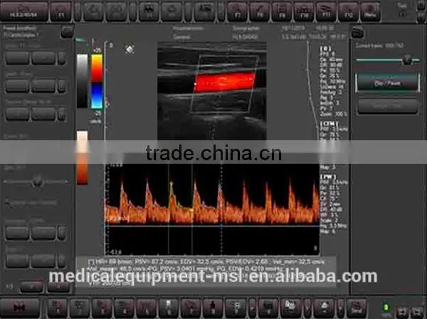 3D Color Doppler Ultrasound Machine With Touch Screen With Competitive Price MSLCU22-N photo-5