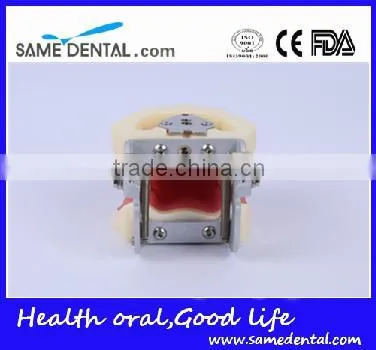 Dental Severe Periodontal Disease Model School Teaching photo-5