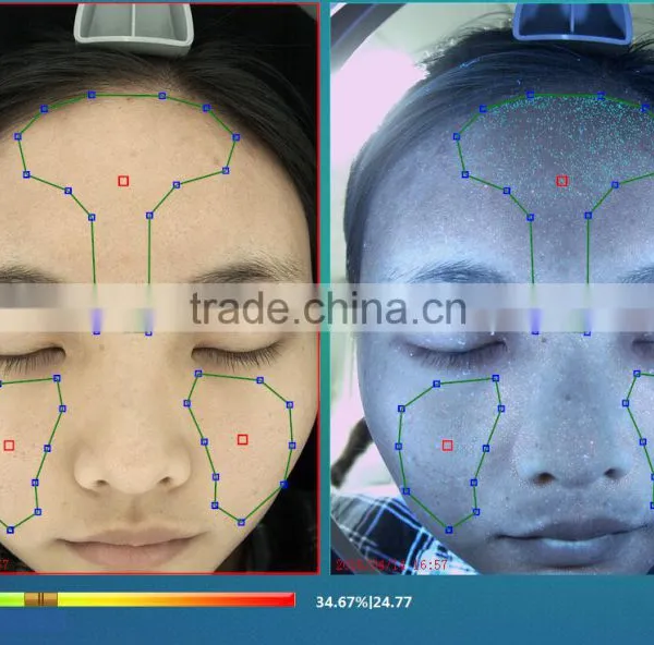 3D Scanners Magic Mirror Facical Skin Scope Spectrum Analyzer Facial Skin Analyzer photo-3
