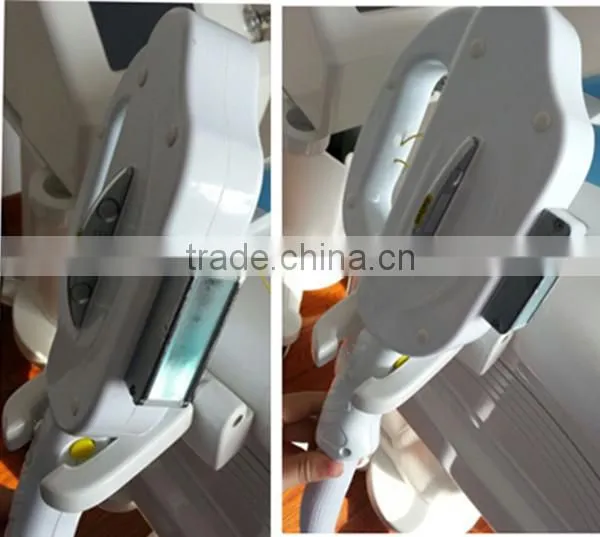 Sun-burn Spots Removal Hair Removal / Portable Ipl Laser Pigment Treatment Hair Removal Machine / Ipl Home Pigmentation Spots Removal photo-2