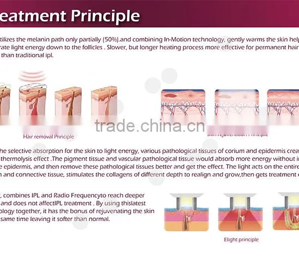 Vertical Type 3 in 1 Alexandrite Laser Best Shr Ipl Machine Hair Removal for Skin Rejuvenation photo-6