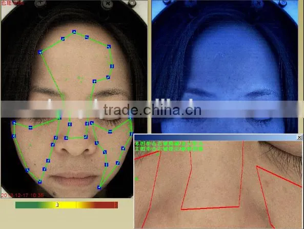 Skin Analyzer Machine Allergy Testing Analyser Machine photo-4