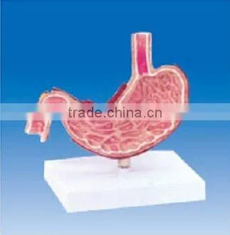 Pathological Stomach Dissection Model