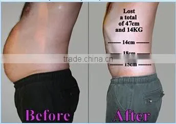 Best Price of Cryotherapy Fat Freeze Machine for Fast and Effective Cellulite Removal photo-4