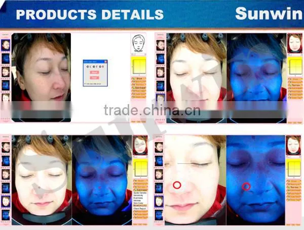 (On Promotion) Professional Skin Analyzer 3D Magic Mirror photo-5