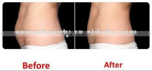 Cavitation Multipolar Tripolar Rf Slimming Body Slimming Machine Fat Reduction Machine For Beauty 5 In 1 Cavitation Machine photo-6