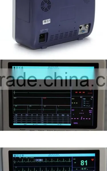 Hot Product Ambulance 12 Inch Multi Parameters ICU Patient Monitor Applicable for Hospital Operation photo-3
