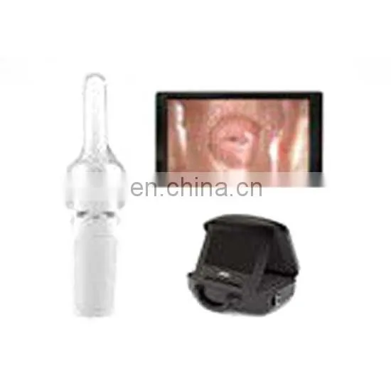 Vaginal Self-Exam Colposcope Digital Video Colposcope Gynecological Mini-Colposcope photo-3
