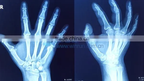 HD Medical Film Special Ink