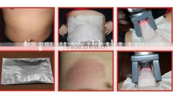 Professional Cryo Sauna Fat Freezing Machine Home Device Buy Chinese Products Online TM-908 photo-5