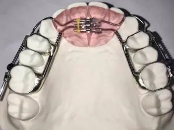 China Dental Laboratory - China Digital Dental Lab China Dental Lab Looks for Cooperation photo-2