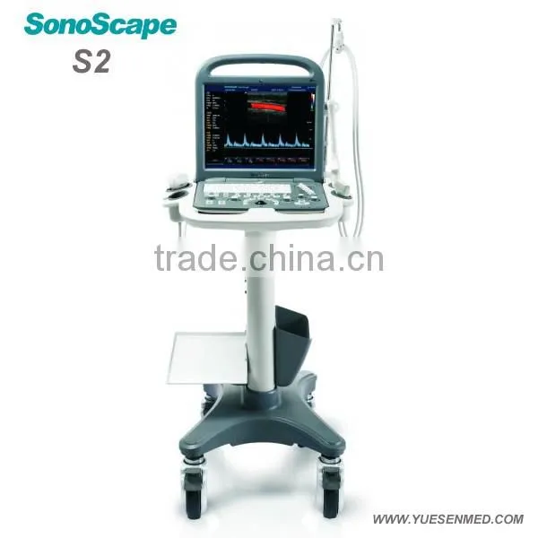 Color Ultrasound Scanner Sonoscape Veterinary Ultrasound photo-6