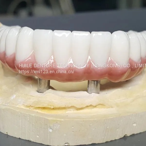 Dental Pfm Crown From China Dental Lab photo-2