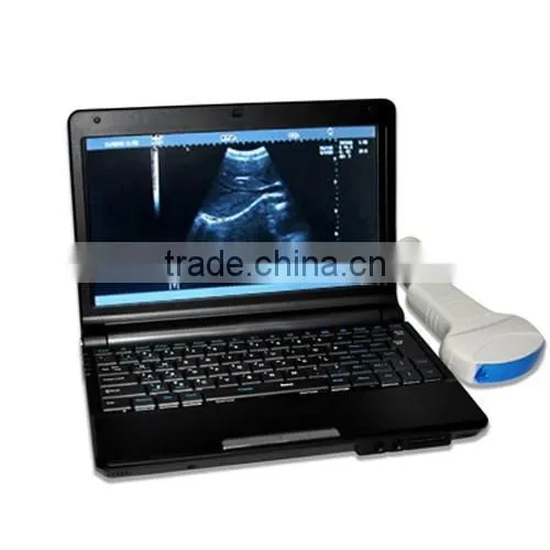 Animal Use Full Digital Veterinary Ultrasound Machine With 3.5MHz Convex Probe Vet RUS-9000V Supplier photo-3