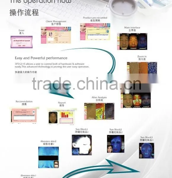 WT-03-S Super Trispectrum Magic Mirror Skin Scanner Analyzer photo-5