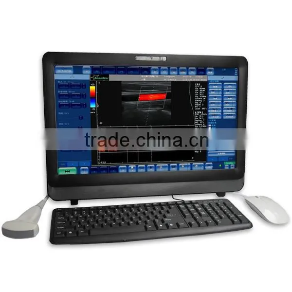 Touch Screen Color Doppler Ultrasound Scanner C8 Model photo-2