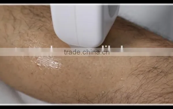 600W Permanent 808nm Diode Laser/laser Diode/diode Laser Hair Removal photo-5