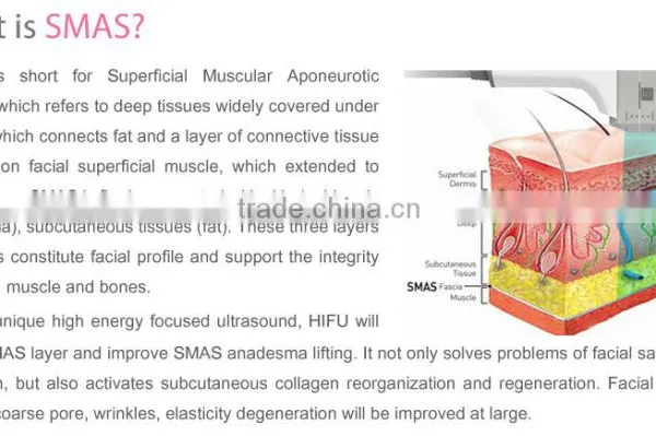 HIFU Wrinkle Removal & Hifu for Skin Tightening, Hifu Body Shape and Weight Loss photo-2