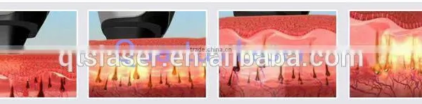 (Two Functions in One Machine) 755nm Laser Hair Removal Machine Not Only Remove Hair but Also Remove Tattoo Easily Used Clinic photo-4