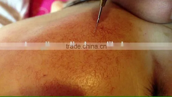 Hot!!Eye Wrinkle Removal/carboxy Therapy Machine/No-Needle Mesotherapy Device photo-2