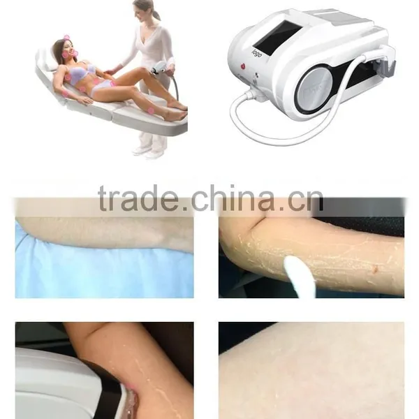 810 Lumenis Lightsheer Duet Laser for Sale photo-5