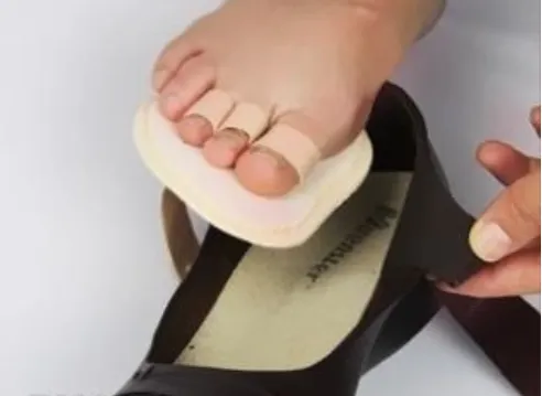 Foot Pad With Overlap Correction of Hallux Valgus Toe Mallet Finger Correction Toe Pad photo-3